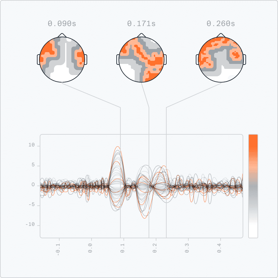 EEG signal patterns and brain wave analysis